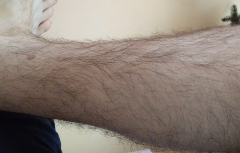 picture8.png picture8.png