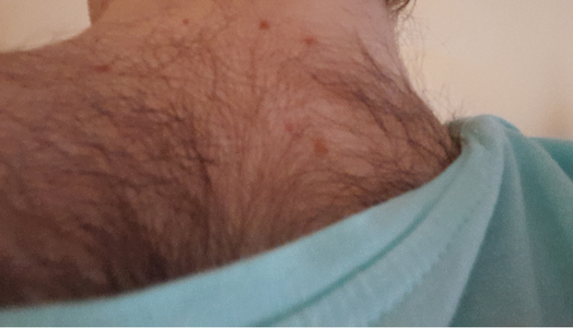 picture11.png picture11.png