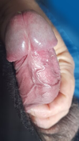 Raging erection.jpg