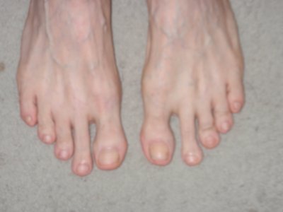 Clipped Toenails - Copy.JPG
