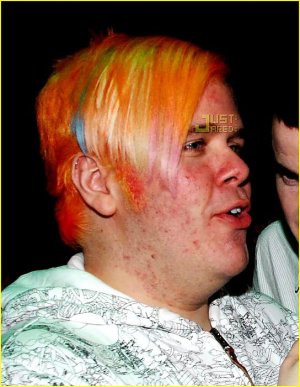 perez-hilton-pimples-02.jpg