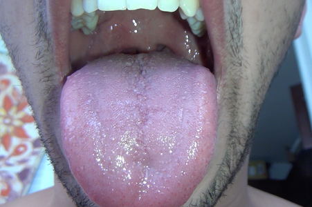 Rico Bad Breath 3.webp