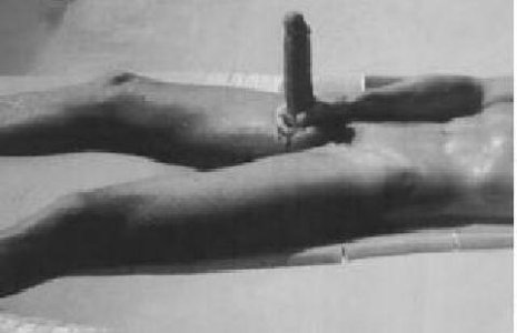 ct-pool1.jpg