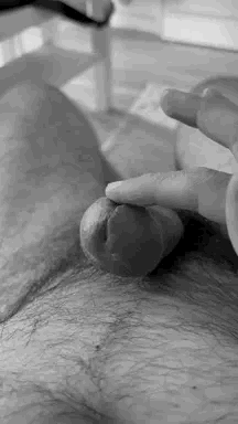 frenulum 0004 89988.gif