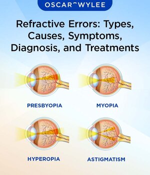 Refractive_Errors_Types_Causes_Symptoms_Diagnosis_and_Treatments_Oscar-Wylee_770x990.jpg