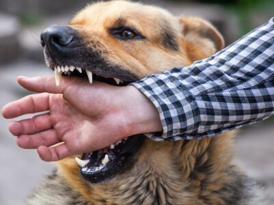 Phoenix-angry-dog-biting-a-man.jpg