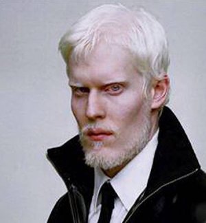 albino1.jpg