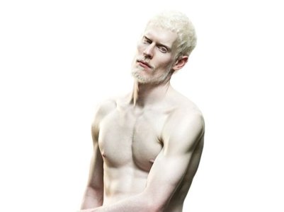 albino_man_ie247-046.jpg