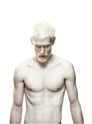 albino_man_ie247-004.jpg