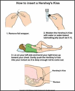 insert-hershey-kiss-rectally.jpg
