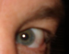 eye.JPG