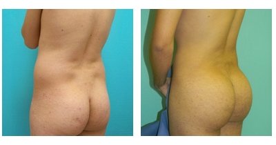 buttimplants.jpg buttimplants.jpg