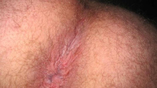 Me in June 2013 my hole another shot.jpg