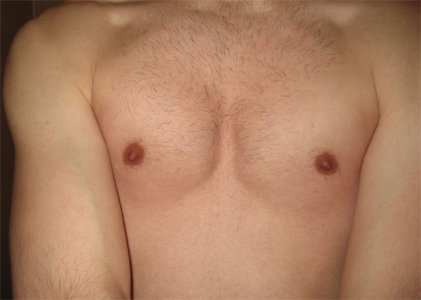 chest1.jpg