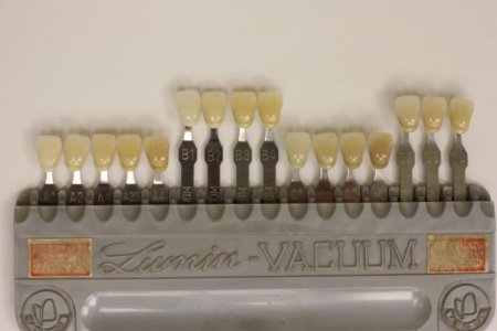 Zahnfarbe_Frabring_20100120_029.jpg Zahnfarbe_Frabring_20100120_029.jpg