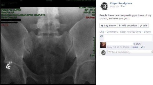 My crotch xray.jpg