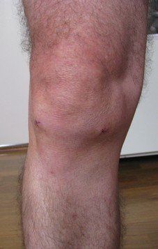 knee1.jpg