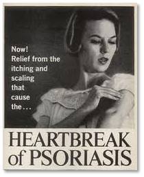 Heartbreak-of-Psoriasis.jpg