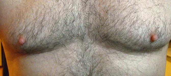 2nipples.jpg