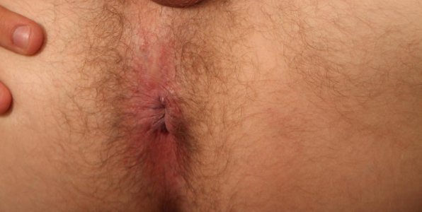 ojete 0e t'w'er w.jpg