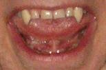 fangmouth.JPG