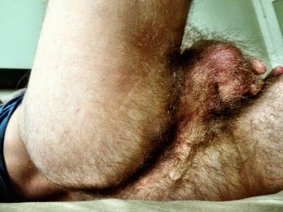 hairy-balls032.jpg