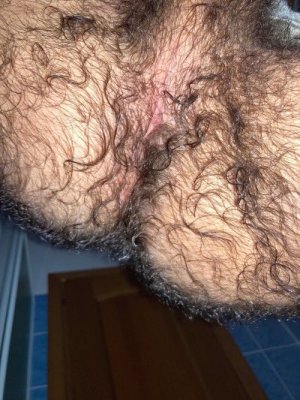 ZVeryhairyAss.jpg