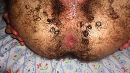 hairy-ass018.jpg