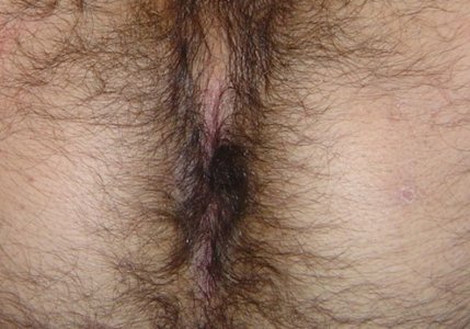 hairy-ass021.jpg