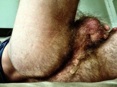 hairy-h01.jpg