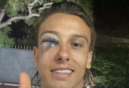 62240b1fb193a.jpeg 62240b1fb193a.jpeg